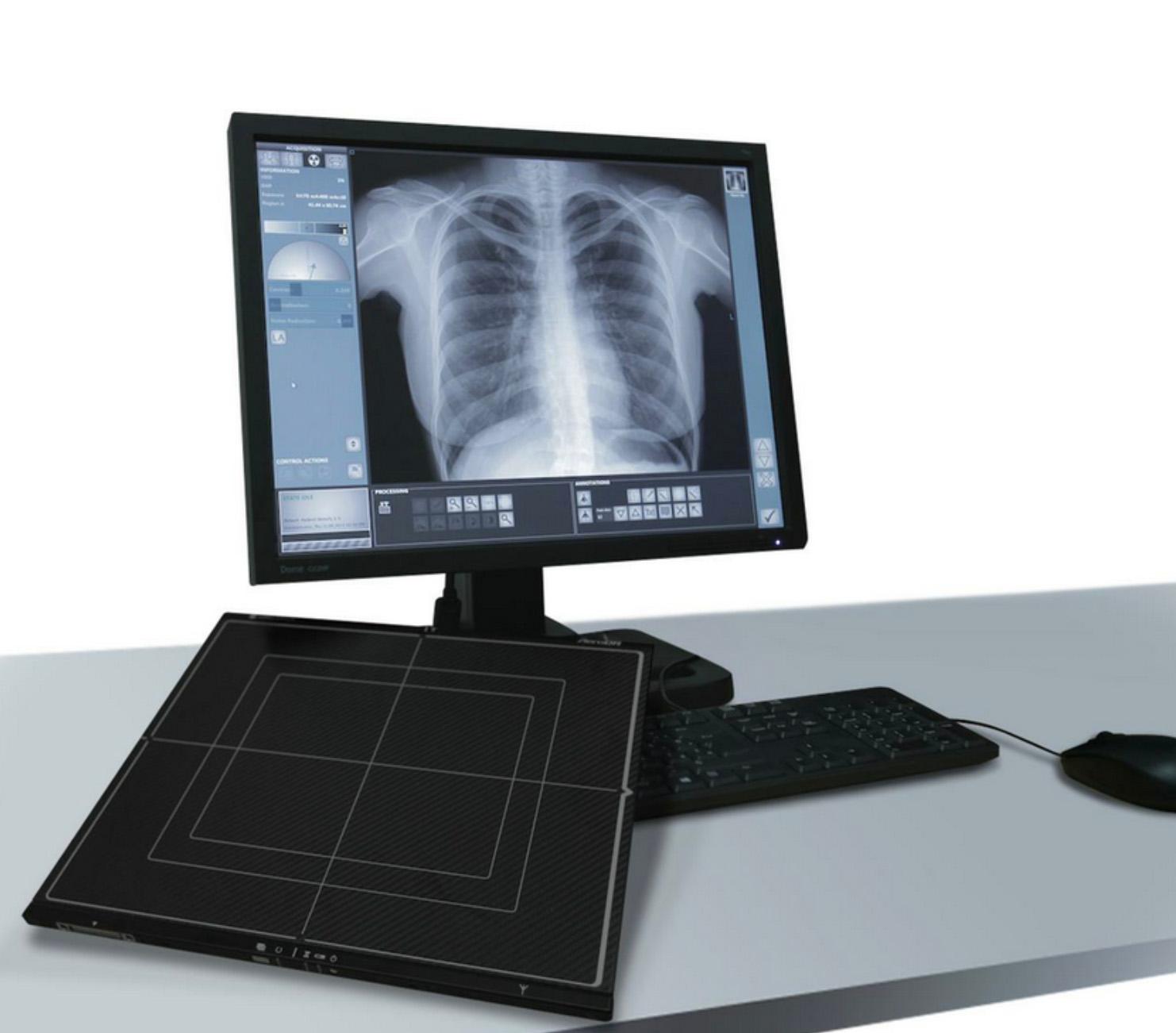 Digital radiography equipment being calibrated